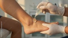 Gloved hands applying gel to a person's ankle during a medical procedure