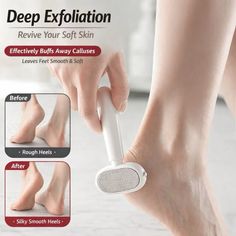 Person using a foot exfoliation tool on their heel, with before and after images