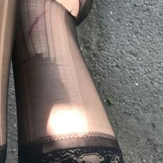 Legs in black stockings with lace trim, with exposed skin and a scratch