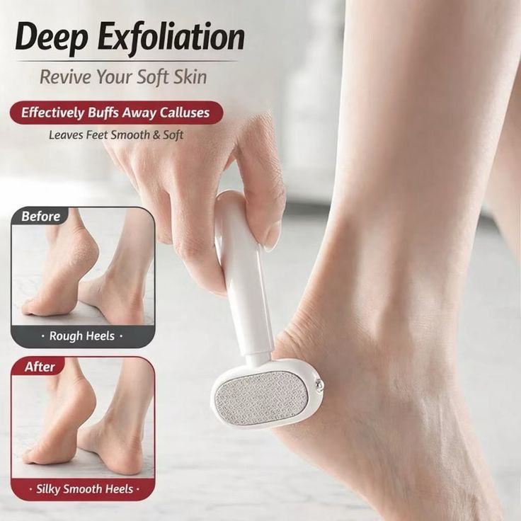 Person using a foot exfoliation tool on their heel, with before and after images