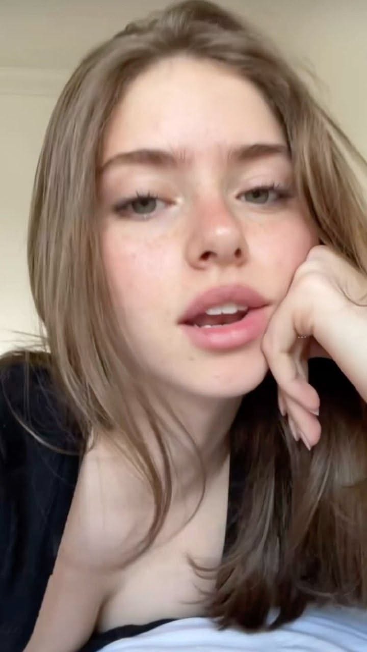 Young woman with long hair and freckles, resting her chin on her hand