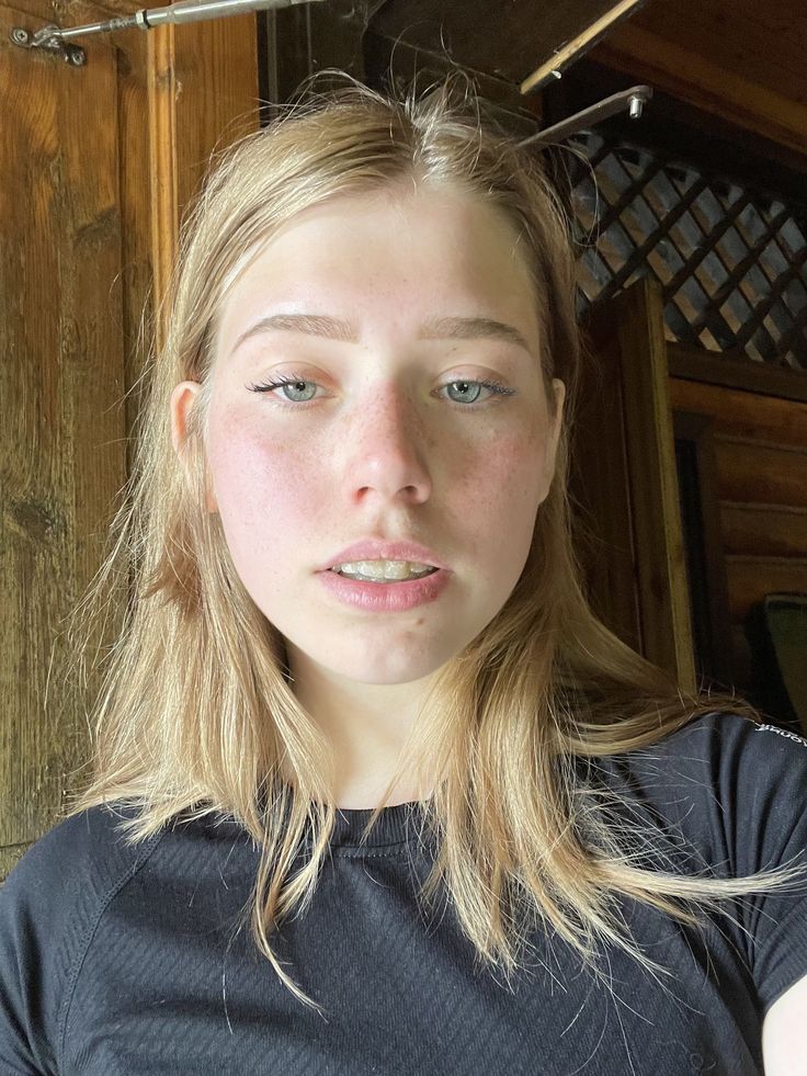 Young woman with blonde hair and braces wearing a black shirt indoors